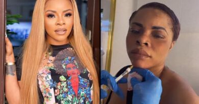 Laura Ikeji shows off her Successful Chin Implant