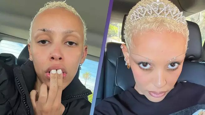 <strong>Doja Cat’s brother accused of abusing her and knocking out her teeth</strong>