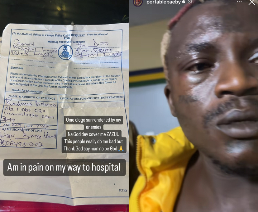 <strong>Singer Portable Hospitalised after alleged assault</strong>