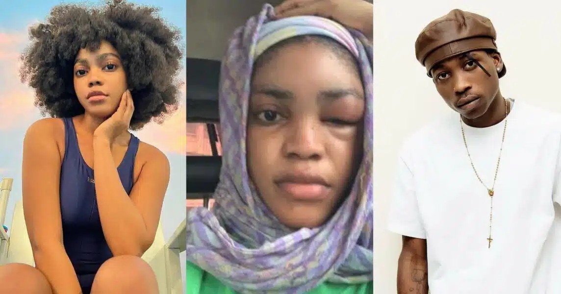 “Lil Frosh is lying, it wasn’t an allergy”- Lil Frosh’s ex-girlfriend shares more proof of assault
