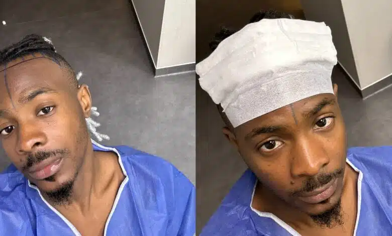 <strong>Young John undergoes hair transplant months after being trolled over his receding hairline</strong>