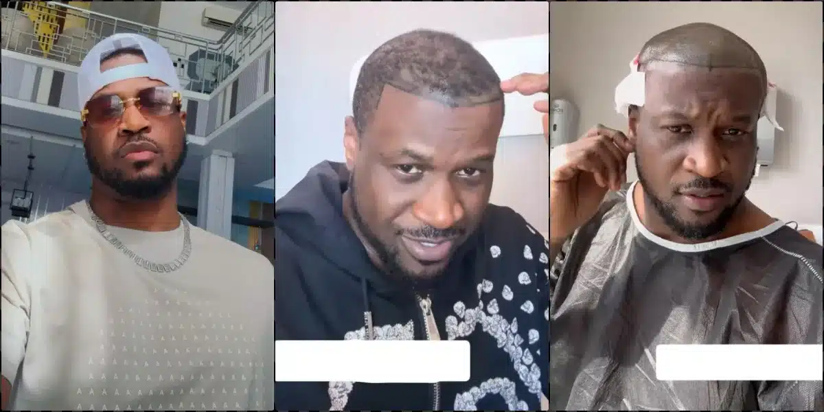 <strong>Peter Okoye undergoes hair transplant in Turkey</strong>