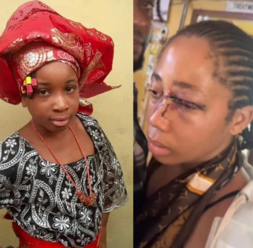 Fresh Update on Brutalised 18-Year-Old Wife